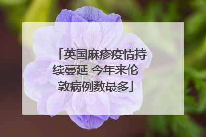 英国麻疹疫情持续蔓延 今年来伦敦病例数最多